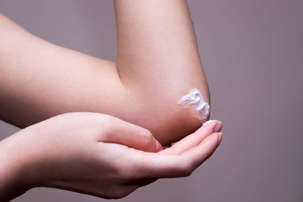 Atopic dermatitis – Causes, symptoms, and more