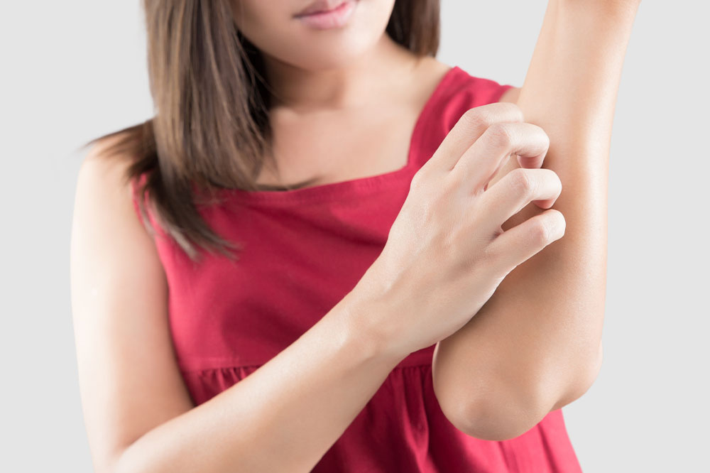 Managing dermatitis – 11 remedies for itchy skin
