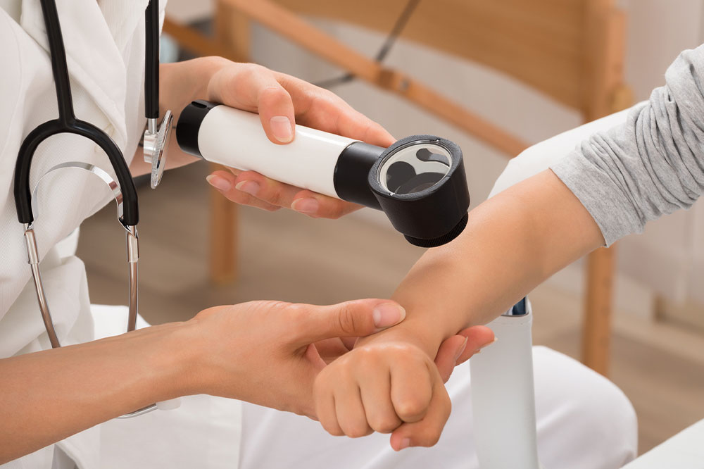 Eczema – Causes, Symptoms, Management, and More